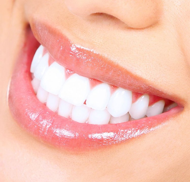 teeth-whitening